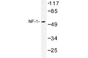 Image no. 1 for anti-Nuclear Factor I/A (NFIA) antibody (ABIN272219) (NFIA antibody)