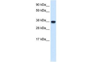 WB Suggested Anti-NMI Antibody Titration:  1. (NMI antibody  (N-Term))
