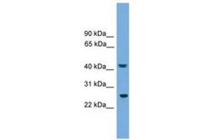 Image no. 1 for anti-RAB35, Member RAS Oncogene Family (RAB35) (AA 71-120) antibody (ABIN6744956) (RAB35 antibody  (AA 71-120))