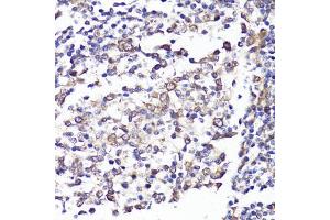 Immunohistochemistry of paraffin-embedded human tonsil using SELL antibody (ABIN3022263, ABIN3022264, ABIN3022265 and ABIN6218704) at dilution of 1:100 (40x lens). (L-Selectin antibody  (AA 1-100))