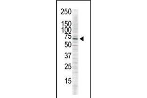 Antibody is used in Western blot to detect CAMK2 delta in serum-starved HeLa cell lysate.