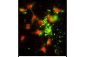 Immunofluorescence analysis of AP17766PU-N SRP72 antibody (Center) with Hela cells. (SRP72 antibody  (Middle Region))