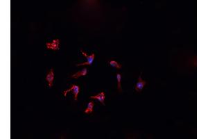 ABIN6276867 staining HepG2? (FTL antibody  (C-Term))