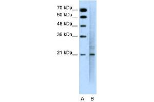Western Blotting (WB) image for anti-Mucin 1 (MUC1) (C-Term) antibody (ABIN635541)