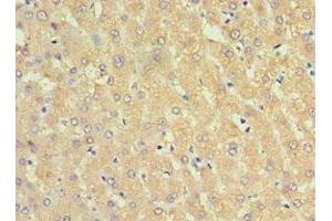 Immunohistochemistry of paraffin-embedded human liver tissue using ABIN7143754 at dilution of 1:100 (SERPINA3 antibody  (AA 24-423))