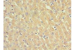 Immunohistochemistry of paraffin-embedded human liver tissue using ABIN7143754 at dilution of 1:100