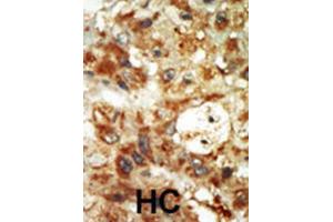 Immunohistochemistry (IHC) image for anti-Mitogen-Activated Protein Kinase 12 (MAPK12) antibody (ABIN5023083) (MAPK12 antibody)
