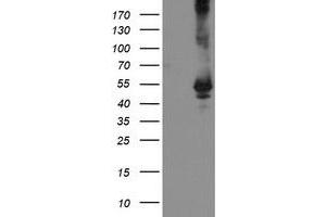 HEK293T cells were transfected with the pCMV6-ENTRY control (Left lane) or pCMV6-ENTRY TDO2 (Right lane) cDNA for 48 hrs and lysed. (TDO2 antibody)