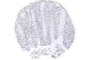 TFE3 staining is lacking in epithelial cells of the appendix (Recombinant TFE3 antibody)
