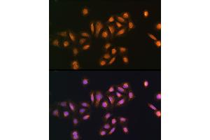 Immunofluorescence analysis of U2OS cells using STK38 antibody (ABIN6132692, ABIN6148616, ABIN6148617 and ABIN6224215) at dilution of 1:100. (STK38 antibody  (AA 1-200))