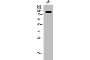 Western Blot analysis of VEC cells using Cleaved-COL1A2 (G1102) Polyclonal Antibody (COL1A2 antibody  (Cleaved-Gly1102))