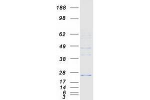 Validation with Western Blot (MPV17L2 Protein (Myc-DYKDDDDK Tag))