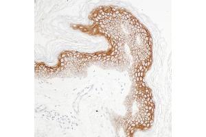 Immunohistochemistry (IHC) image for anti-Claudin 1 (CLDN1) (C-Term) antibody (ABIN7453966) (Recombinant Claudin 1 antibody  (C-Term))