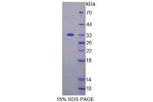 SDS-PAGE analysis of Human JPH3 Protein. (Junctophilin 3 Protein (JPH3))