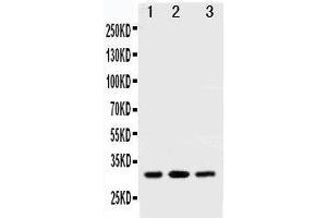 Anti-SDHB antibody, Western blotting All lanes: Anti SDHB  at 0.