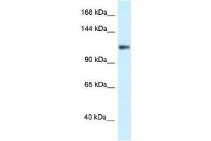 Western Blot showing KCNH3 antibody used at a concentration of 1. (KCNH3 antibody  (N-Term))