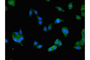 Immunofluorescent analysis of HepG2 cells using ABIN7145589 at dilution of 1:100 and Alexa Fluor 488-congugated AffiniPure Goat Anti-Rabbit IgG(H+L) (BAAT antibody  (AA 313-400))