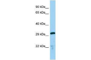 Host:  Rabbit  Target Name:  Tmx2  Sample Type:  Mouse Lung lysates  Antibody Dilution:  1.