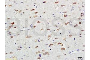 Formalin-fixed and paraffin embedded rat brain labeled with Anti-Nox4/NADH Polyclonal Antibody, Unconjugated (ABIN737526) at 1:200 followed by conjugation to the secondary antibody and DAB staining.