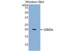 Western blot analysis of the recombinant protein. (GDF7 antibody  (AA 295-447))