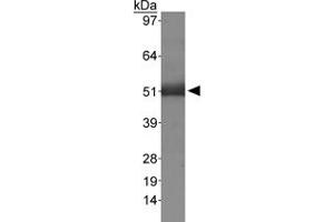 Western blot analysis of MSR1 in human liver using MSR1 polyclonal antibody . (Macrophage Scavenger Receptor 1 antibody  (AA 300-400))