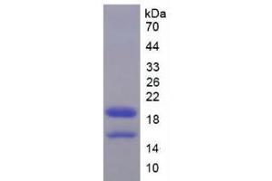 SDS-PAGE analysis of Mouse HMGA1 Protein. (HMGA1 Protein)
