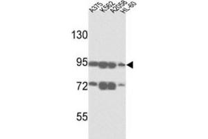Western Blotting (WB) image for anti-ATP-Binding Cassette, Sub-Family B (MDR/TAP), Member 5 (ABCB5) antibody (ABIN3002513)