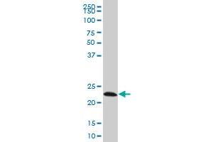 EFHD1 monoclonal antibody (M08A), clone 1F5 Western Blot analysis of EFHD1 expression in Hela S3 NE . (EFHD1 antibody  (AA 168-238))