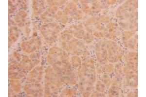 Figure. (TPSAB1 antibody  (AA 161-262))