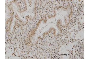 Immunoperoxidase of monoclonal antibody to SCML1 on formalin-fixed paraffin-embedded human endometrium. (SCML1 antibody  (AA 3-100))