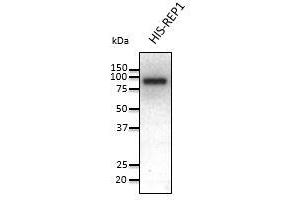 Anti-REP1 Ab at 1/1,000 dilution, 50 ng of recombinant protein per lane, rabbit polyclonal to goat lgG (HRP) at 1/10,000 dilution