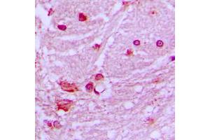 Immunohistochemical analysis of DNAL1 staining in human brain formalin fixed paraffin embedded tissue section. (DNAL1 antibody  (Center))