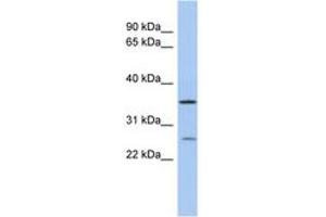 Image no. 1 for anti-Short Chain Dehydrogenase/reductase Family 9C, Member 7 (SDR9C7) (C-Term) antibody (ABIN6743679) (SDR9C7 antibody  (C-Term))