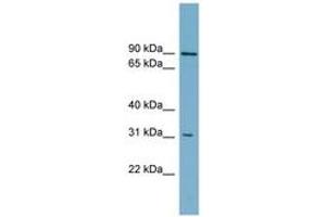 Image no. 1 for anti-ATP-Binding Cassette, Sub-Family D (ALD), Member 2 (Abcd2) (C-Term) antibody (ABIN6743193) (Abcd2 antibody  (C-Term))