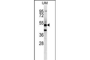 PNLIPRP3 Antibody (N-term) (ABIN656711 and ABIN2845941) western blot analysis in uterus tumor cell line lysates (35 μg/lane). (PNLIPRP3 antibody  (N-Term))