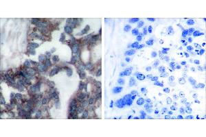 Peptide - +Immunohistochemical analysis of paraffin-embedded human breast carcinoma tissue using Claudin 1 antibody (#C0142).