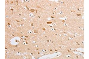 The image on the left is immunohistochemistry of paraffin-embedded Human brain tissue using ABIN7131039(SERPINE2 Antibody) at dilution 1/20, on the right is treated with fusion protein. (SERPINE2 antibody)