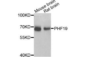Western blot analysis of extracts of various cells, using PHF19 antibody. (PHF19 antibody)