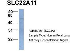 Host:  Rabbit  Target Name:  SLC22A11  Sample Type:  Human Fetal Lung  Antibody Dilution:  1. (SLC22A11 antibody  (C-Term))