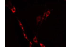 ABIN6275233 staining Hela by IF/ICC. (MRPS21 antibody  (C-Term))