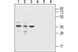 Western blot analysis of acute monocytic leukemia THP-1 (lanes 1 and 4), promyelocytic leukemia HL-60 (lanes 2 and 5) and acute T-cell leukemia Jurkat (lanes 3 and 6) human cell lysates: - 1,2,3. (CysLTR1 antibody  (3rd Extracellular Loop))