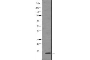 Western blot analysis of TCEB1 expression in Jurkat cell line lysates ,The lane on the left is treated with the antigen-specific peptide. (TCEB1 antibody  (N-Term))