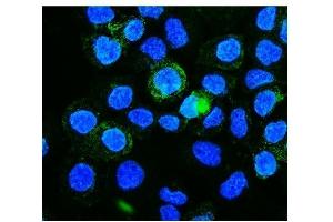 IF analysis of PICALM using anti-PICALM antibody (ABIN7599516). (PICALM antibody  (AA 1-652))