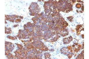Formalin-fixed, paraffin-embedded human Parathyroid stained with PTH Monoclonal Antibody (PTH/1174).