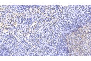 Detection of VCAM1 in Rabbit Spleen Tissue using Monoclonal Antibody to Vascular Cell Adhesion Molecule 1 (VCAM1) (VCAM1 antibody  (AA 409-682))