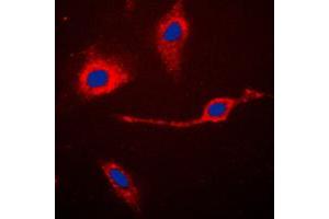 Immunofluorescent analysis of Caspase 3 p17 staining in Jurkat cells. (Caspase 3 p17 (Center) antibody)