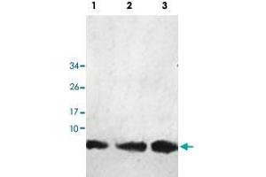 Western blot analysis of human fetal kidney (Lane 1), fetal liver (Lane 2) and fetal heart (Lane 3) lysate with HHLA3 polyclonal antibody  at 1 : 1000 dilution. (HHLA3 antibody  (AA 1-122))