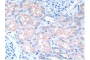 IHC-P analysis of Human Kidney Tissue, with DAB staining. (GNB1L antibody  (AA 69-247))