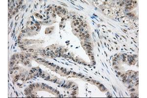 Image no. 10 for anti-Transforming, Acidic Coiled-Coil Containing Protein 3 (TACC3) antibody (ABIN1498097) (TACC3 antibody)