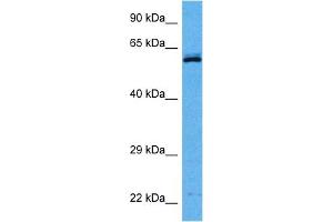 Host:  Rabbit  Target Name:  CCT8  Sample Tissue:  Mouse Testis  Antibody Dilution:  1ug/ml
